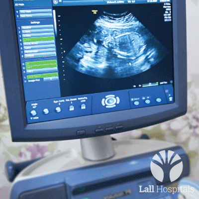 Ultrasound 3D and 4D